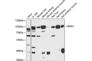 Western blot analysis of extracts of various cell lines, using IR antibody (ABIN6130497, ABIN6142514, ABIN6142515 and ABIN6216327) at 1:3000 dilution. (IRAK1 抗体  (AA 424-633))