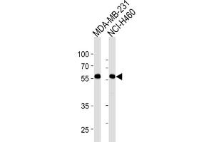 Western Blotting (WB) image for anti-Raftlin, Lipid Raft Linker 1 (RFTN1) antibody (ABIN3004469) (RFTN1 抗体)