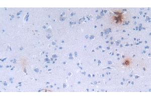 Immunohistochemistry (IHC) image for anti-Defensin, alpha 3, Neutrophil-Specific (DEFa3) (AA 21-94) antibody (ABIN7439243)