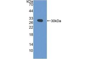 Detection of Recombinant PDCD6IP, Mouse using Polyclonal Antibody to Programmed Cell Death Protein 6 Interacting Protein (PDCD6IP)