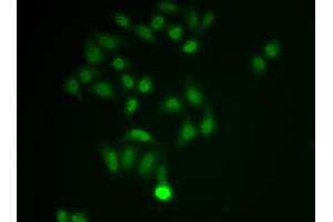 Immunofluorescence analysis of MCF-7 cell using CHAT antibody. (Choline Acetyltransferase 抗体  (AA 331-630))