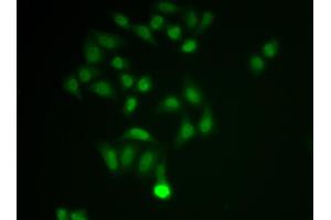 Immunofluorescence analysis of MCF-7 cell using CHAT antibody. (Choline Acetyltransferase 抗体  (AA 331-630))