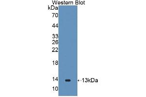 Western blot analysis of the recombinant protein. (GALP 抗体  (AA 29-115))