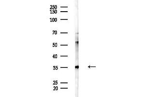 Western blot analysis of lysates from HepG2 cells(LPS, 4h treatment), using ATP6V0 Antibody at 1/1000 dilution.