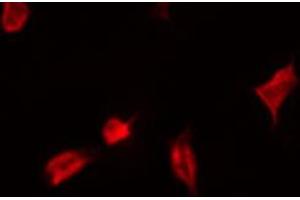 ABIN6267537 staining Hela by IF/ICC. (YAP1 抗体  (pSer127))