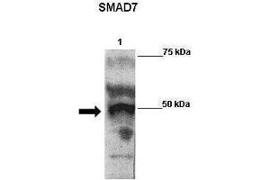 WB Suggested Anti-SMAD7 Antibody    Positive Control:  Lane 1: 2ug Flag-SMAD7 transfected 293 extracts   Primary Antibody Dilution :   1:500  Secondary Antibody :  Goat anti-rabbit-HRP   Secondry Antibody Dilution :   1:5000  Submitted by:  Anonymous (SMAD7 抗体  (N-Term))