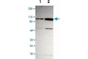 Western Blot analysis of Lane 1: RT-4 and Lane 2: U-251MG sp cell lysates with ZNF267 polyclonal antibody . (ZNF267 抗体)