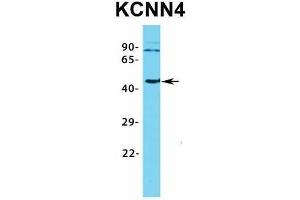 Western Blotting (WB) image for anti-Potassium Intermediate/small Conductance Calcium-Activated Channel, Subfamily N, Member 4 (KCNN4) (C-Term) antibody (ABIN2776147)