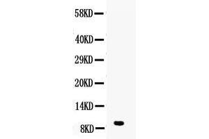 Western blot analysis of DBI using anti-DBI antibody . (Diazepam Binding Inhibitor 抗体  (AA 2-87))