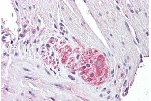 Anti-NTN4 / Netrin 4 antibody IHC staining of human small intestine, myenteric plexus. (Netrin 4 抗体  (AA 65-76))