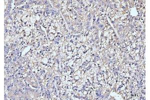 IHC analysis of ITCH/AIP4 using anti-ITCH/AIP4 antibody (ABIN7600263).