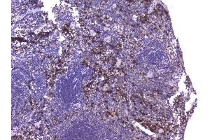 IHC analysis of CCL8 using anti-CCL8 antibody (ABIN6719605). (CCL8 抗体  (AA 24-97))