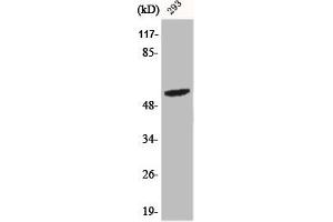 Western Blot analysis of 293 cells using Phospho-Shb (Y246) Polyclonal Antibody (SHB 抗体  (pTyr246))