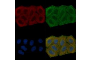 ABIN6265789 and ABIN6278090 staining Hela cells(30 min of UV treatment) by IF/ICC. (TUBA1B 抗体  (N-Term))