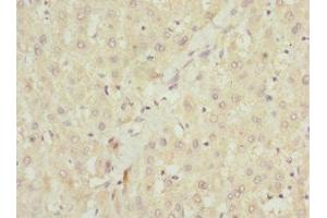 Immunohistochemistry of paraffin-embedded human liver tissue using ABIN7151087 at dilution of 1:100 (NHLRC1 抗体  (AA 1-280))