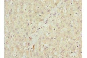 Immunohistochemistry of paraffin-embedded human liver tissue using ABIN7151087 at dilution of 1:100 (NHLRC1 抗体  (AA 1-280))