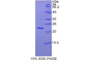 SDS-PAGE analysis of Rat Pannexin 1 Protein. (PANX1 蛋白)