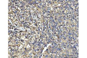 IHC analysis of UBA5 using anti-UBA5 antibody (ABIN7601503). (UBA5 抗体  (AA 37-389))