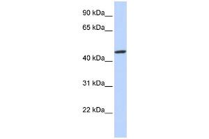 WB Suggested Anti-ZNF239 Antibody Titration:  0. (ZNF239 抗体  (N-Term))