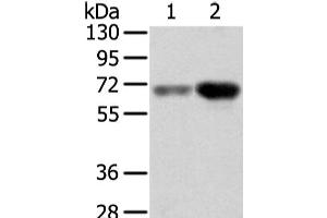 Western Blot analysis of Human lung cancer and placenta tissue using TBL1X Polyclonal Antibody at dilution of 1/500 (TBL1X 抗体)