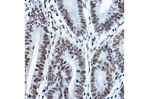 Immunohistochemistry (IHC) image for anti-MYST Histone Acetyltransferase 2 (MYST2) (AA 55-193) antibody (ABIN6142689)