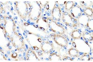 Immunohistochemistry of paraffin-embedded Mouse kidney using RNF149 Polyclonal Antibody at dilution of 1:100 (40x lens). (RNF149 抗体)