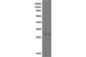 Western Blot analysis of Rat kidney tissue using IL10 Polyclonal Antibody at dilution of 1:600 (IL-10 抗体)