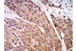 Immunohistochemistry (IHC) image for anti-Purinergic Receptor P2X, Ligand-Gated Ion Channel, 7 (P2RX7) (AA 226-452) antibody (ABIN5542663)