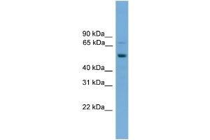 WB Suggested Anti-SKIL  Antibody Titration: 0. (SKIL 抗体  (Middle Region))