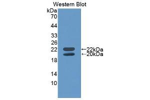 Western blot analysis of the recombinant protein. (IGFBP3 抗体  (AA 140-271))