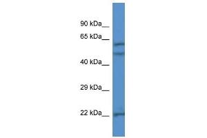 Western Blot showing HPSE antibody used at a concentration of 1 ug/ml against Jurkat Cell Lysate (HPSE 抗体  (N-Term))