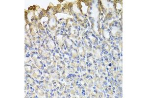 Immunohistochemistry of paraffin-embedded mouse stomach using TUBB8 antibody. (Tubulin, beta 8 抗体)
