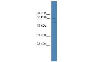 WB Suggested Anti-SPATA2 Antibody Titration: 0. (SPATA2 抗体  (C-Term))