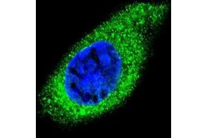Immunofluorescence (IF) image for anti-Collagen, Type XXI, alpha 1 (COL21A1) (AA 211-240), (Chain alpha 1), (N-Term) antibody (ABIN951631)