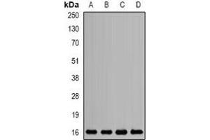 Western blot analysis of Mms2 expression in SKOV3 (A), HL60 (B), mouse liver (C), rat brain (D) whole cell lysates. (UBE2V2 抗体)