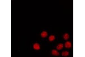 Immunofluorescence (fixed cells) (IF/ICC) image for anti-Sp1 Transcription Factor (SP1) (pThr453) antibody (ABIN6256566)