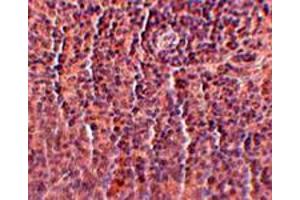 Immunohistochemical staining of rat spleen tissue with 2. (ORAI3 抗体  (C-Term))