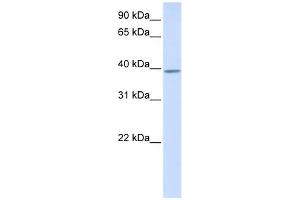 KLHDC2 antibody used at 1 ug/ml to detect target protein. (KLHDC2 抗体  (N-Term))