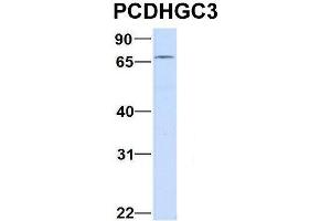 Host:  Rabbit  Target Name:  CHAD  Sample Type:  Human Adult Placenta  Antibody Dilution:  1. (Protocadherin gamma Subfamily C, 3 (PCDHGC3) (C-Term) 抗体)
