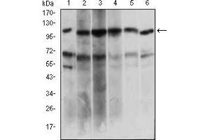 Western blot analysis using PAPLN mouse mAb against Hela (1), HepG2 (2), OCM-1 (3), Raji (4), Jurkat (5), NIH/3T3 (6) cell lysate. (PAPLN 抗体  (AA 766-870))