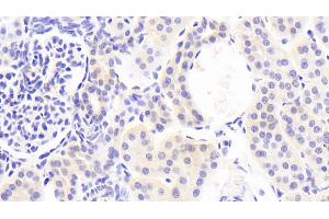 Detection of CDHOB in Human Kidney Tissue using Polyclonal Antibody to Cadherin, Osteoblast (CDHOB) (OB Cadherin 抗体  (AA 374-595))