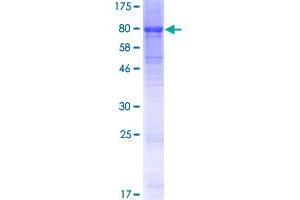 KLHL23 Protein (AA 1-558) (GST tag)