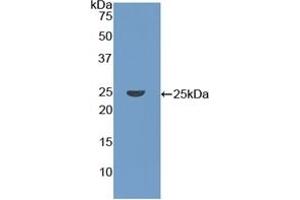 Western Blotting (WB) image for anti-Coronin, Actin Binding Protein, 1A (CORO1A) (AA 7-204) antibody (ABIN7436672)