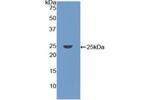 Detection of Recombinant CORO1A, Human using Polyclonal Antibody to Coronin 1A (CORO1A) (Coronin 1a 抗体  (AA 7-204))