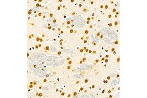 Immunohistochemistry of paraffin embedded mouse brain using RB1 (ABIN7075477) at dilution of 1:700 (400x lens)