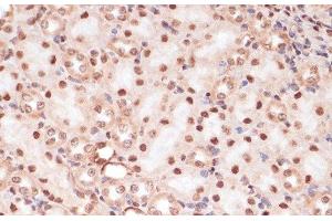Immunohistochemistry of paraffin-embedded Mouse kidney using Phospho-β-catenin(S33/S37/T41) Polyclonal Antibody at dilution of 1:100 (40x lens).