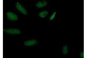 Immunofluorescent staining of HeLa cells using anti-AP2M1 mouse monoclonal antibody (ABIN2454660). (AP2M1 抗体  (AA 97-383))