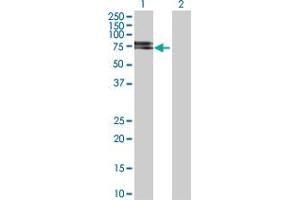 Western Blotting (WB) image for anti-Neurotrophic Tyrosine Kinase, Receptor, Type 2 (NTRK2) (AA 1-477) antibody (ABIN518450)
