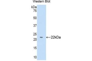 Detection of Recombinant a1BG, Human using Polyclonal Antibody to Alpha-1-B-Glycoprotein (a1BG) (A1BG 抗体  (AA 22-206))