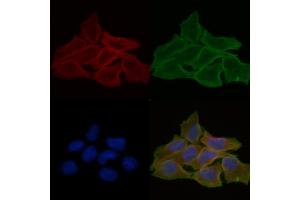 ABIN6258861 and ABIN6274219 staining Hela cells(30 min of UV treatment) by IF/ICC. (ITPKB 抗体  (Internal Region))